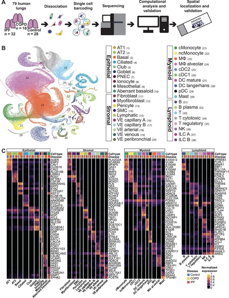 1/n The #IPFCellAtlas is finally out! We profiled 312,928 cells from 32 IPF, 28 controls, 18 COPD lungs using @10xGenomics #scRNAseq & identified previously unidentified populations of epithelial & endothelial cells enriched in IPF #CureIPF advances.sciencemag.org/content/6/28/e…