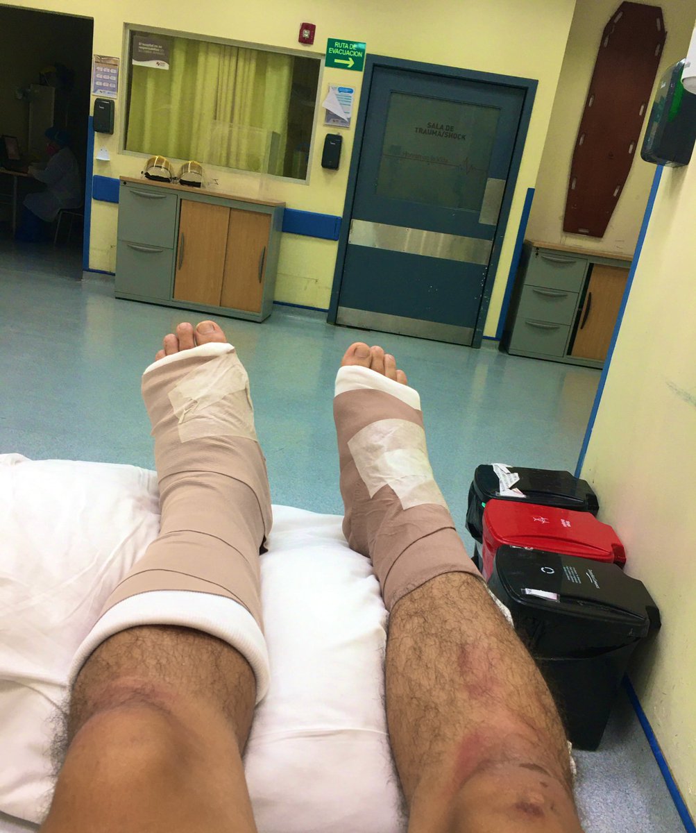 Enriquetabara31's tweet photo. Bueno, ya me estoy mejorando y parando de a poco... gracias a esas personas que estuvieron pendiente de mi situación, no camino del todo pero sigo progresando... #trambolico https://t.co/DEnEcSUenH