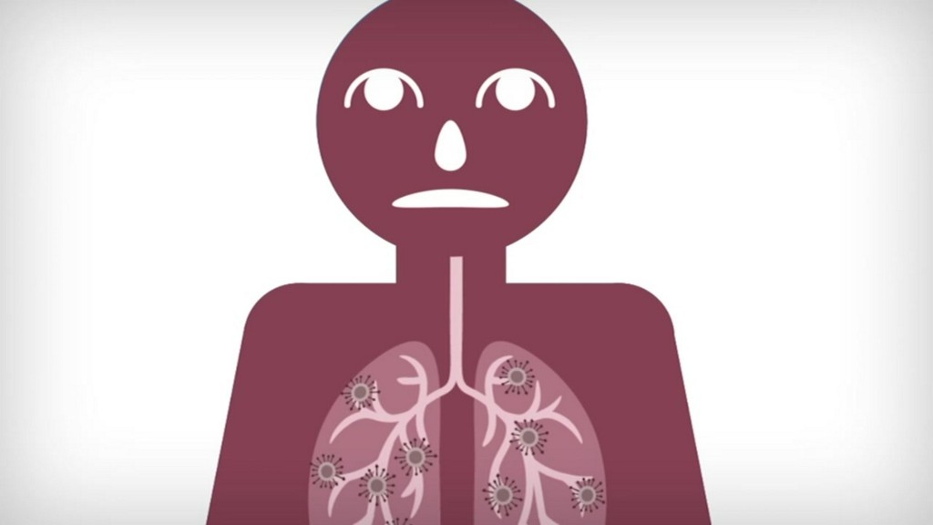 An increase in people dying at home suggests coronavirus deaths in Houston may be higher than reported abc13.co/3iHeLW0