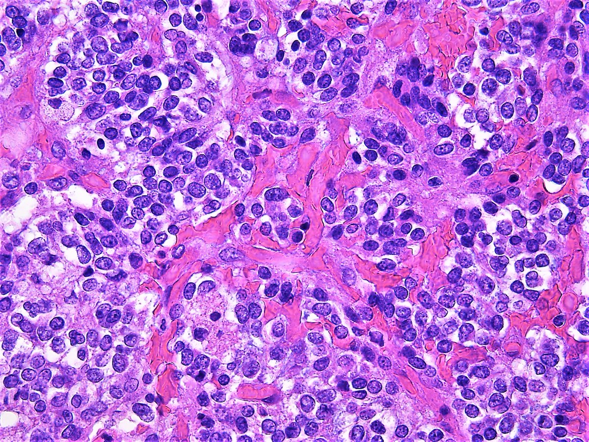 Pathology Walker@Auto Tweet Bot tweet media