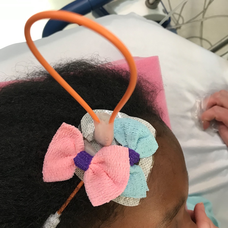 A proper southern #Pediatric #Neurosurgery #ICP #Charleston