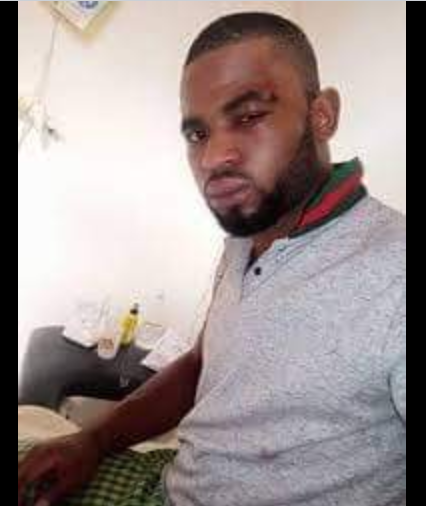 MimiMefoInfo's tweet photo. The case of incarcerated web journalist, Paul Chouta has witnessed another setback.
The pressman's request for provisional release was rejected. His case was once more adjourned, this time to July 22, 2020.
MMI https://t.co/9rUbO5Pm5N