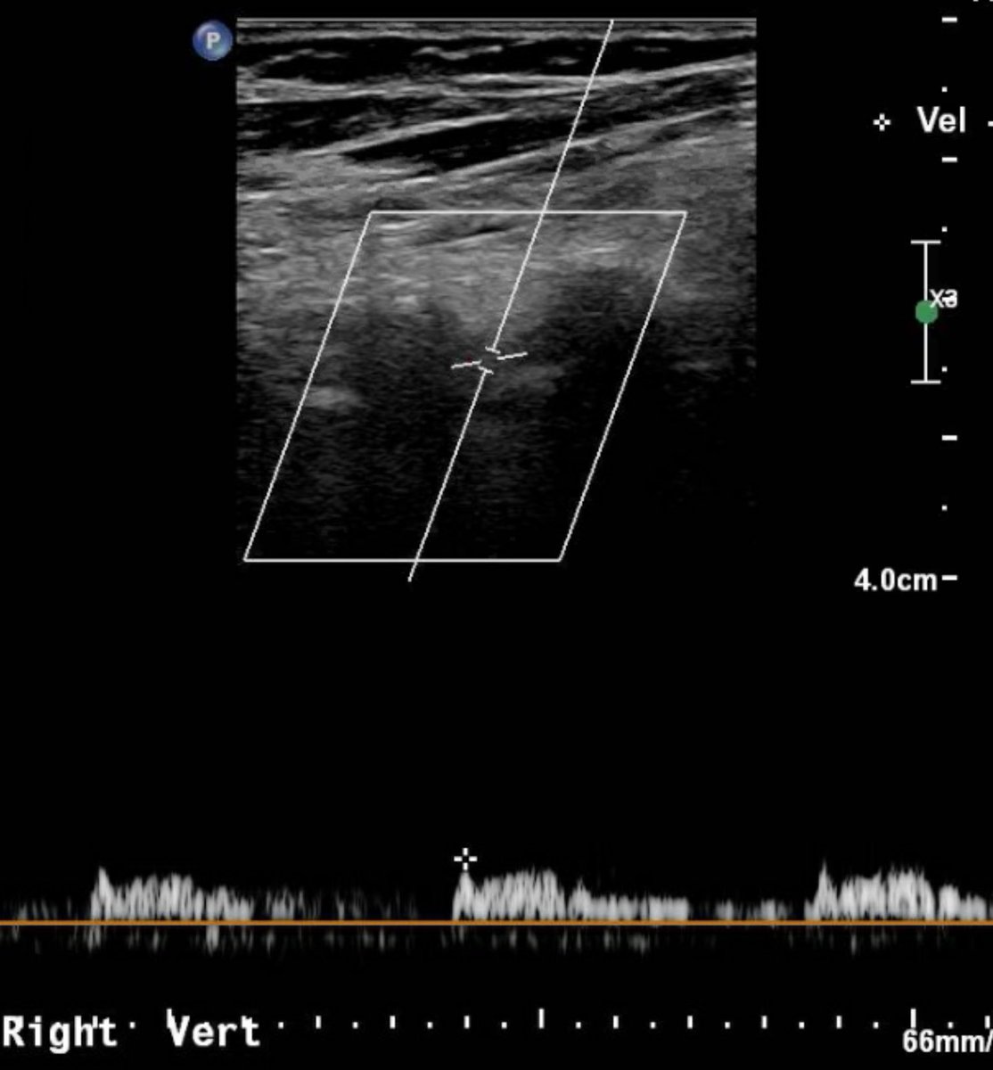 Joseph Kallini, MD tweet media