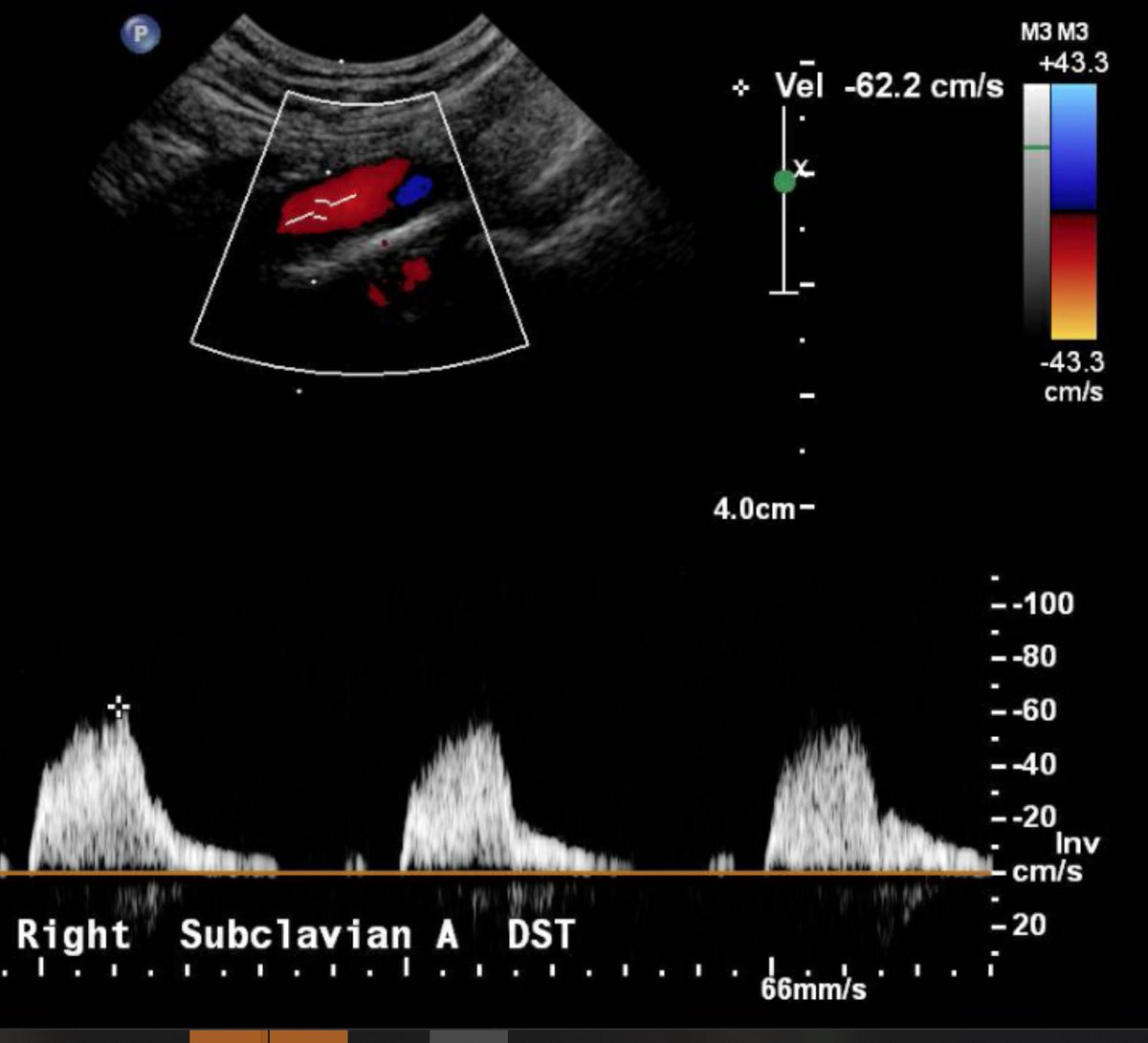 Joseph Kallini, MD tweet media