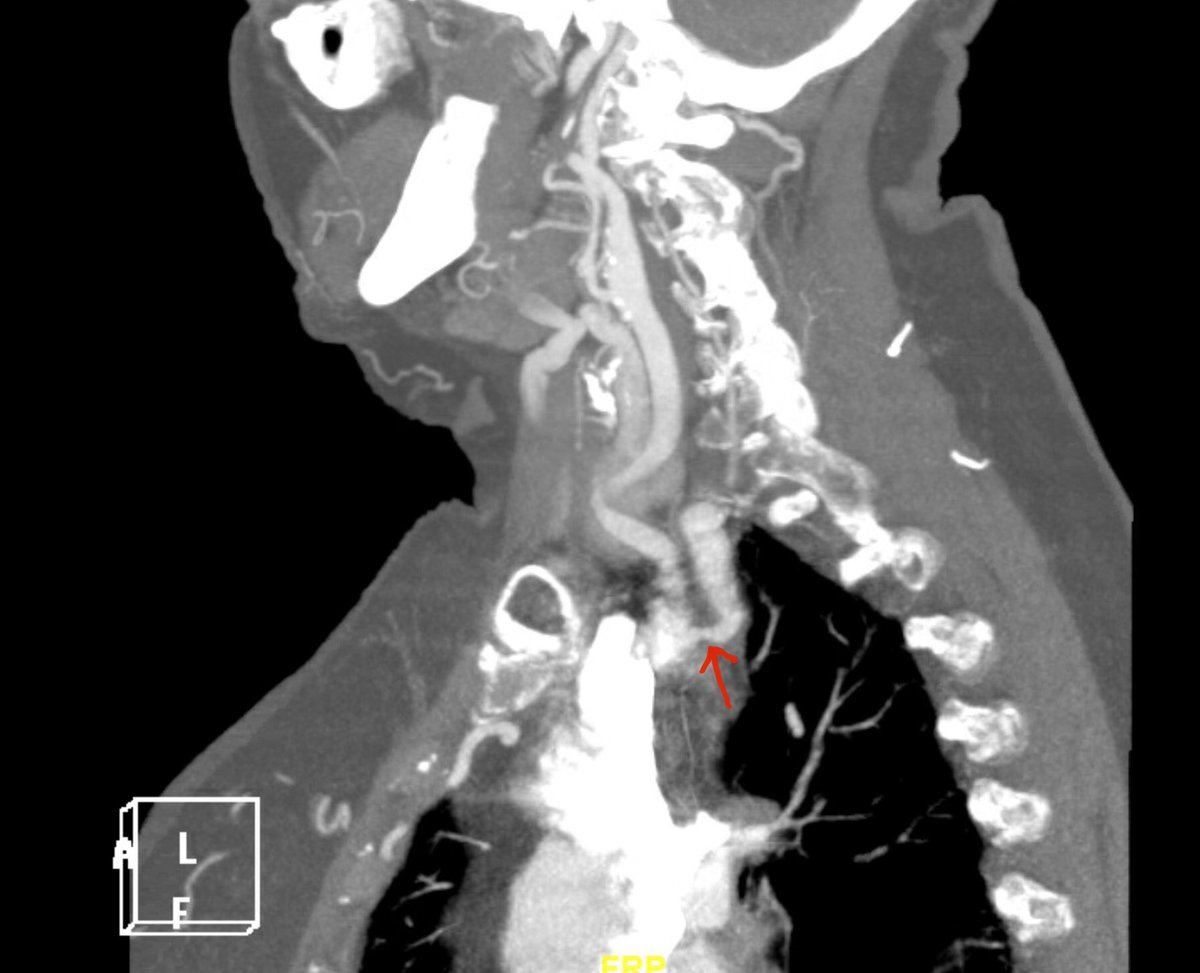 Joseph Kallini, MD tweet media