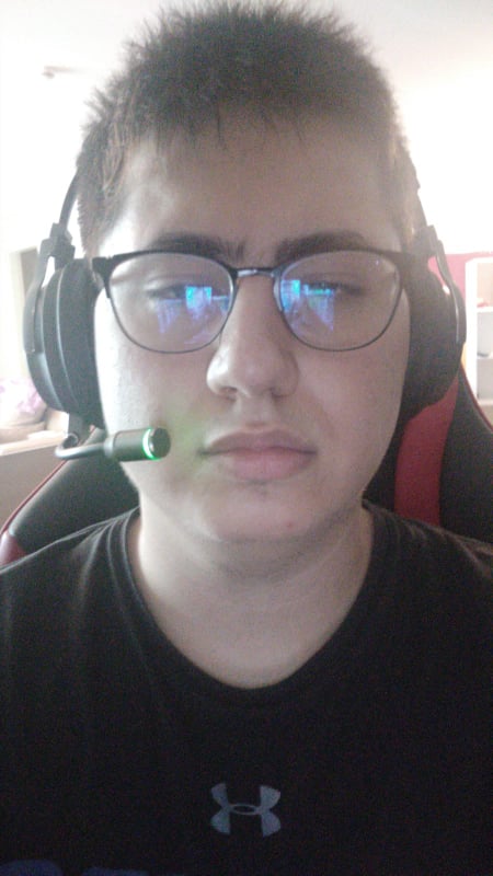 Arı sokmuş galiba.