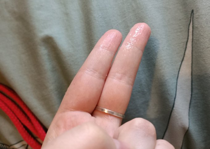 Just some pics of my fingers https://t.co/g2QFFihDOo