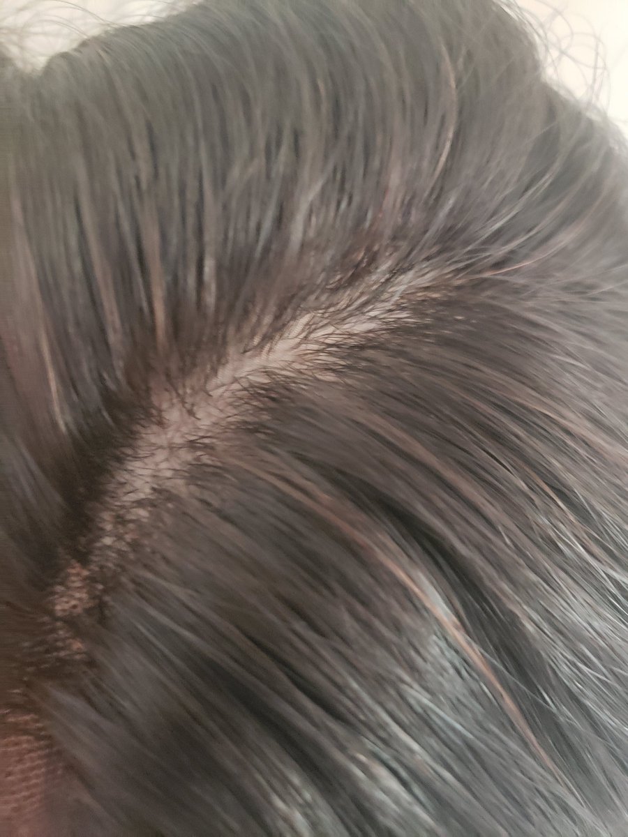 Crowned_ByKelly's tweet photo. Shop Silk Base Lace Front Wigs @crowned_bykellywigs .
.straight .24in
.360 silk Base lace wig .
.
. #frontalwig #frontal #gluelesswig #humanhairwigs #frontals #closurewig #frontalinstall #hairstyles #hairextensions #atlantahairstylist #closuresewin #bhfyp
https://t.co/8IZRnWZO42 https://t.co/6eiHp88Gez