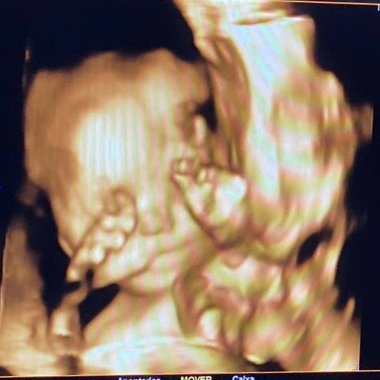 Nossa escorpiana reservada não curte muito mostrar o rostinho! Kkk💓 #babyG