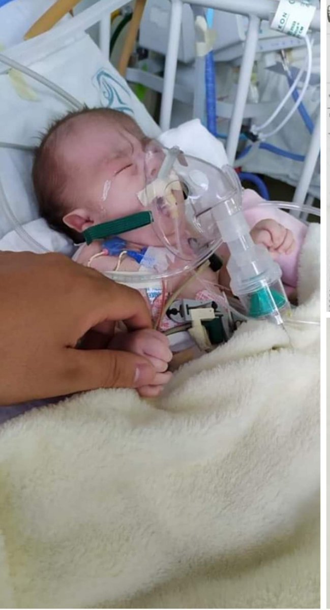 rubssame's tweet photo. Buen día Amigos. Ella es Valentina y tiene Trisomía 18, y está luchando por su vida, está hospitalizada en el Centro Médico de Occidente de Guadalajara cama 235b. Necesita un respirador tipo ventilador. Please RT @medranoazteca @Trafico_ZMG @Chivas @GarciaPosti @TapiaFernanda https://t.co/NXiXJGNnyB