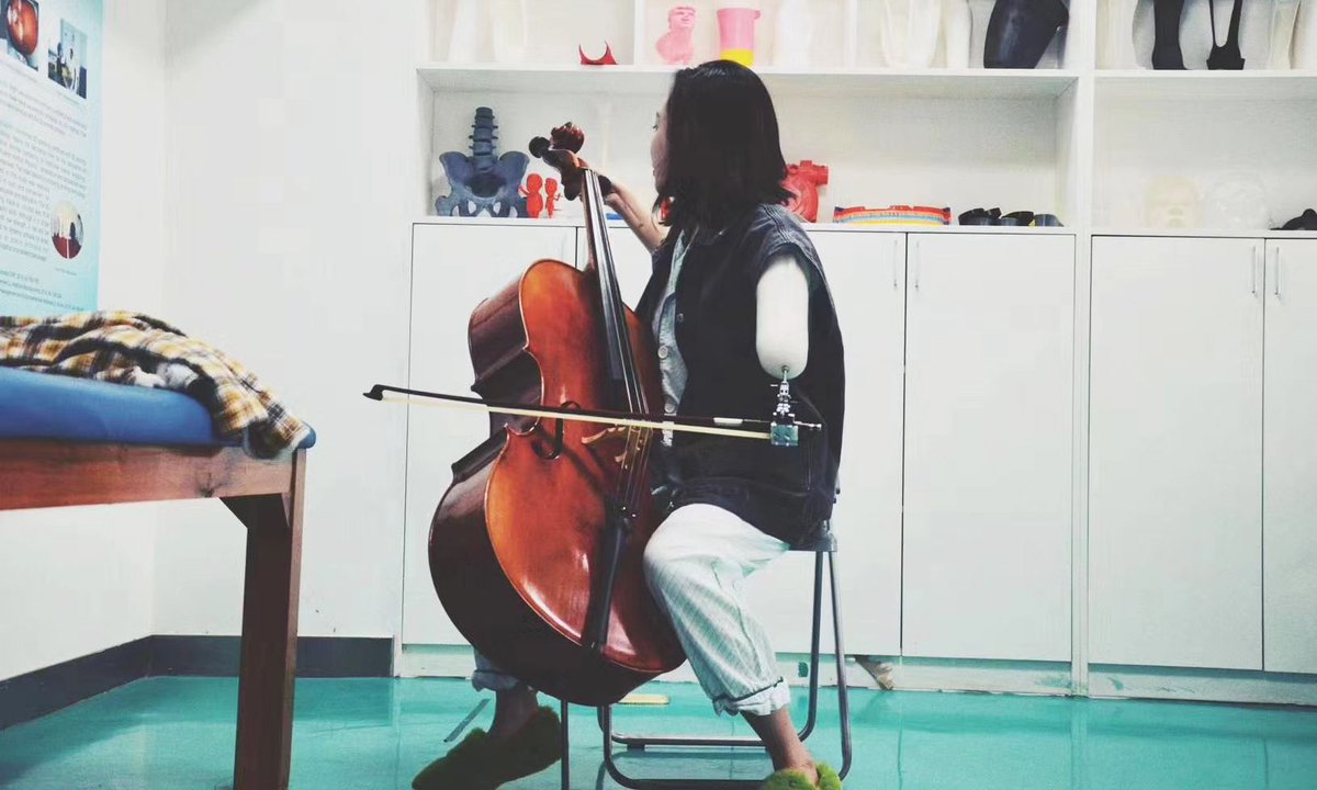 facfox3d's tweet photo. Nothing could stop a person chasing his/her dream. We helped 3D print the customized functional prosthesis for a viola player who lost her forearm in an accident.
More:https://t.co/7czxLwqgmX
#3dprinting #prosthesis #prothetics #3dprinted #dream #viola #musician #accessibility https://t.co/Kes487XDCQ