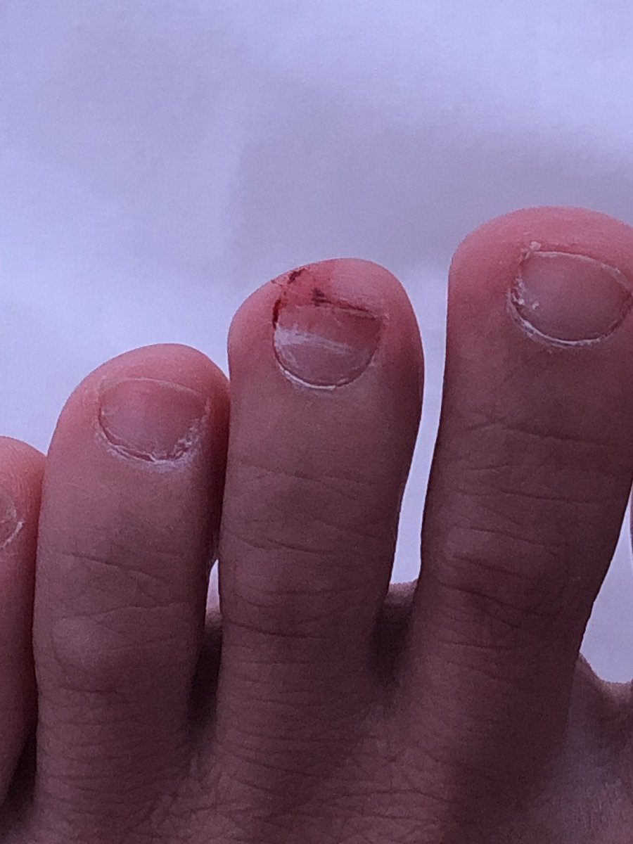 Perasaan uda naikin standart motor, jadi kejepit :( pake perasaan mulu sih jadi aja sakit