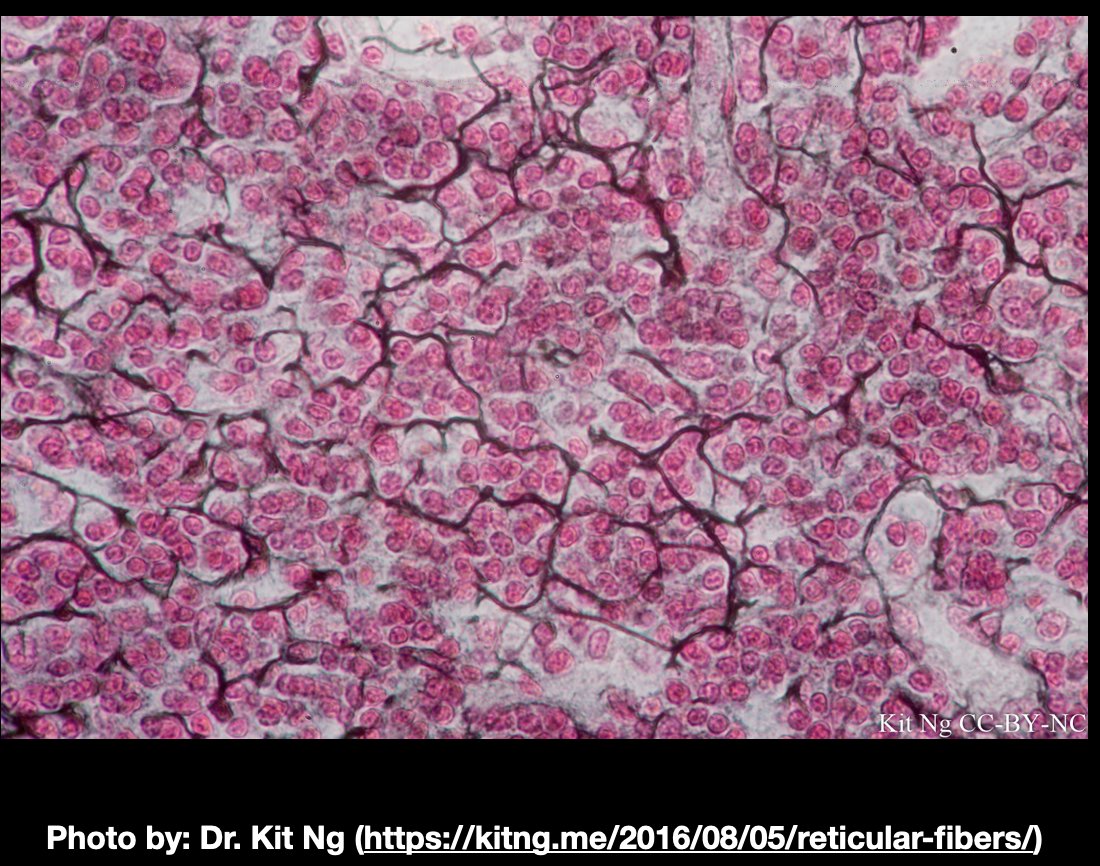 3. Often for us scientists, our teaching is based on our research, but in this project it went the other way, it was partly inspired by teaching histology. One of my favorite things to show students are silver stains of reticular fibers in lymphoid tissue.  https://www.flickr.com/photos/146824358@N03/40885194425/in/album-72157666241437517/