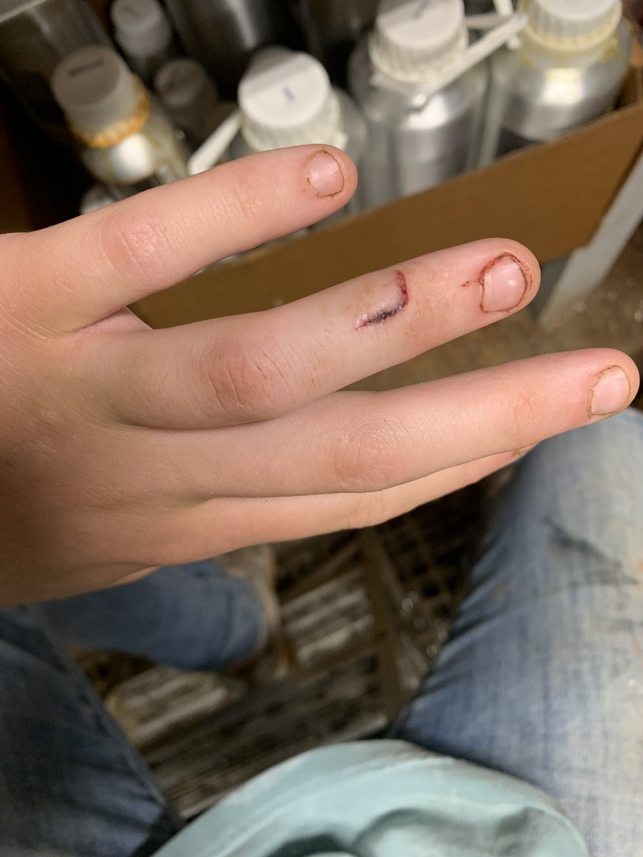 EngramTaylor's tweet image. Worst pain I have ever felt so far, after two rounds of super glue