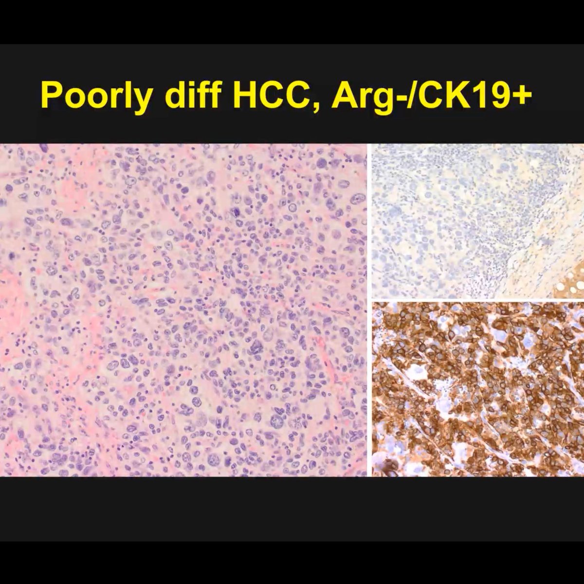 Greta Evaristo, MD tweet media