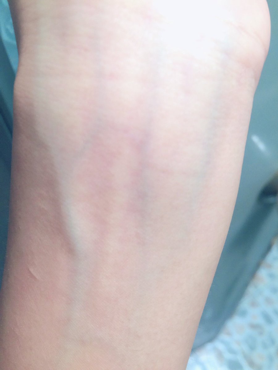 รีล่า เห็นรอยที่ขีดจางๆทั้งหลายเหล่านั้นไหมครับ? ผมเป็นอีกคนที่เค้าเคยขายฝันให้ แต่พอจะทำจริงๆเค้ากลับจูงผมไปยังเส้นทางที่เค้าคิดไว้ให้แล้ว(1)