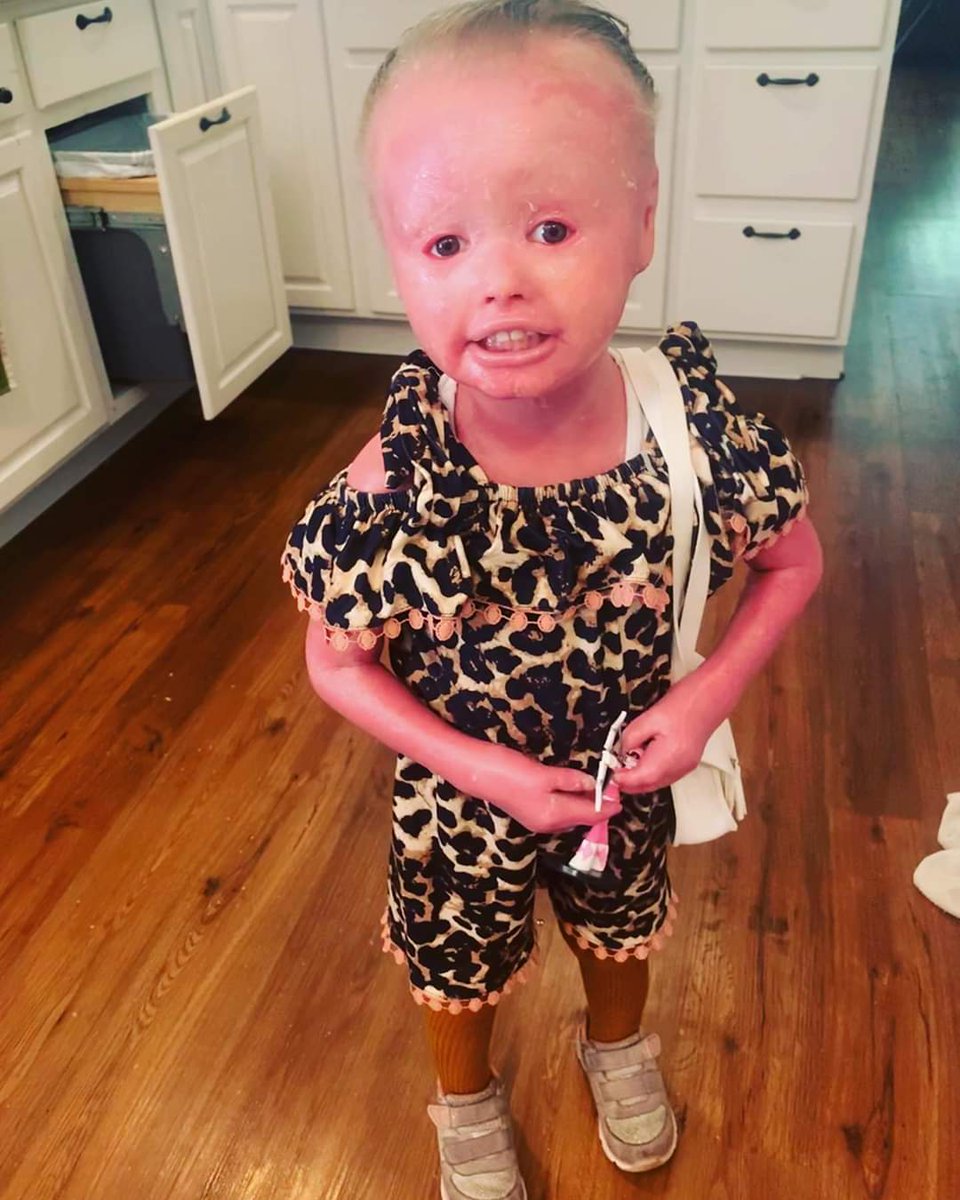 sciub2020's tweet photo. HOPE FOR ANNA
@instashopboutique_ sent Anna a few outfits to try out and we are in love 😍 she also got this adorable white purse and glasses ♥️♥️#stopbeingsocute #toddlermodel #cheetahprint #love #style #diva #harlequindiva https://t.co/VhidgDOh6U