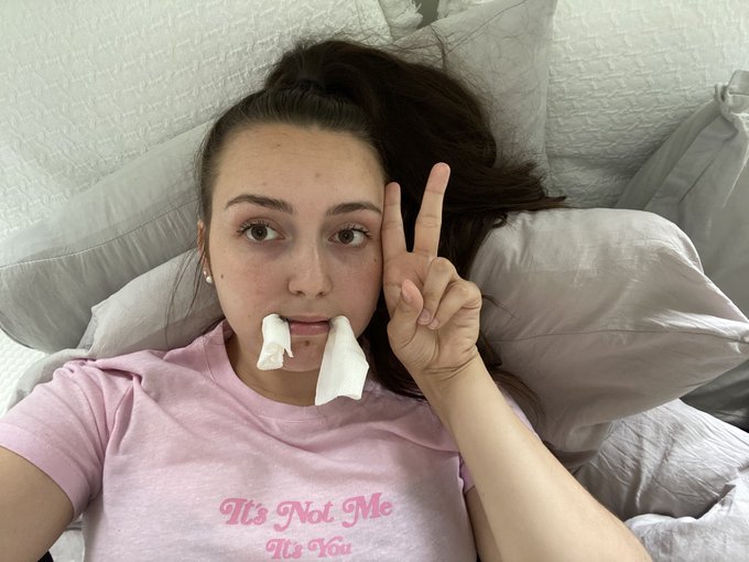 Thanks for your kind words my wisdom teeth are out, I was wide awake, 100% conscious and I&rsquo;m home resting