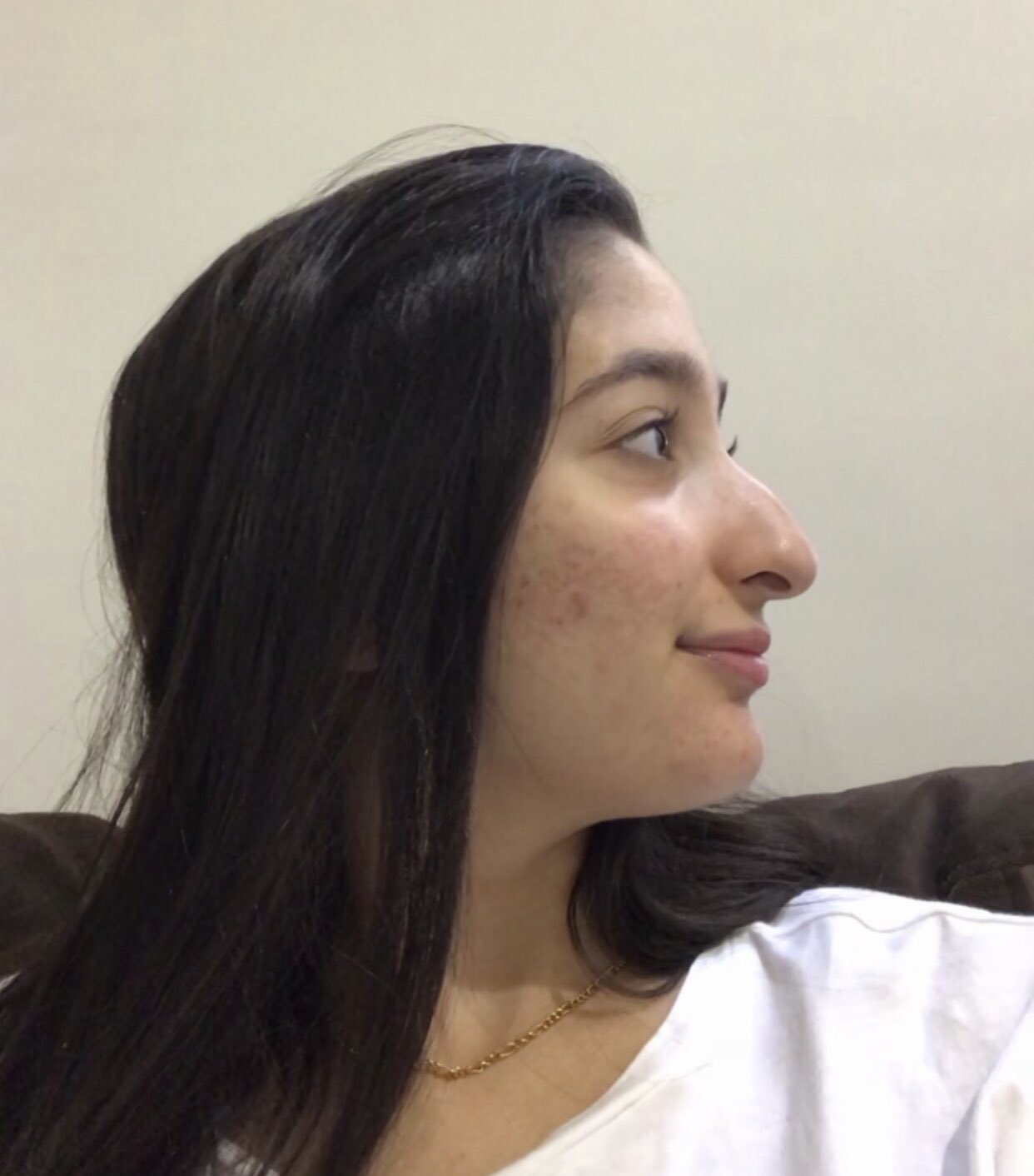 Амина тендерлибае нос