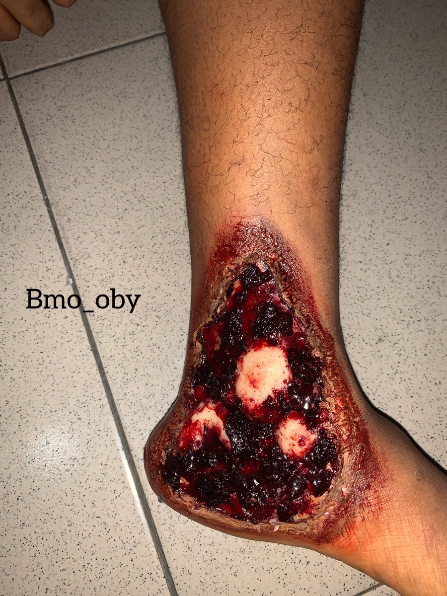 Good evening 👋
I noticed I haven’t really done an SFX makeup lately. So here it is guys🥰.My Dad saw this and was like 🤢🤮😂😂MUA: me. Please help me retweet till it gets to the movie industry Check my IG account @bmo_oby Goodnight 🌝 
 #IgweTacha