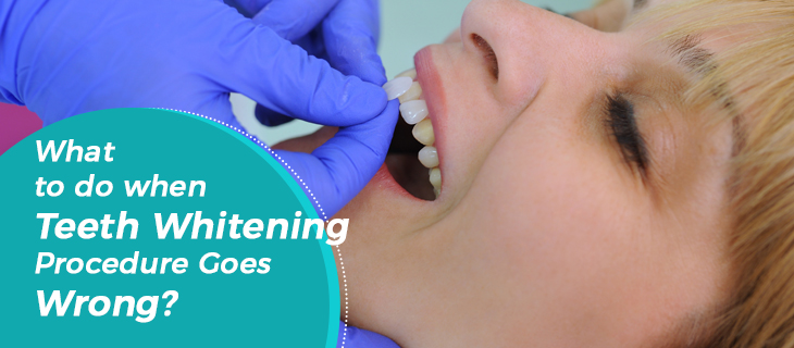 MartinElsia's tweet photo. 💥What To Do When Teeth Whitening Procedure Goes Wrong💥
Teeth whitening treatments are about making your teeth appear brighter and whiter by a few shades. Talk to your dentist in case the...
👉https://t.co/5uWkYRAaB1
#teethwhiteningtreatments #londonteethwhitening #dentistry https://t.co/ejk8HJRmBp