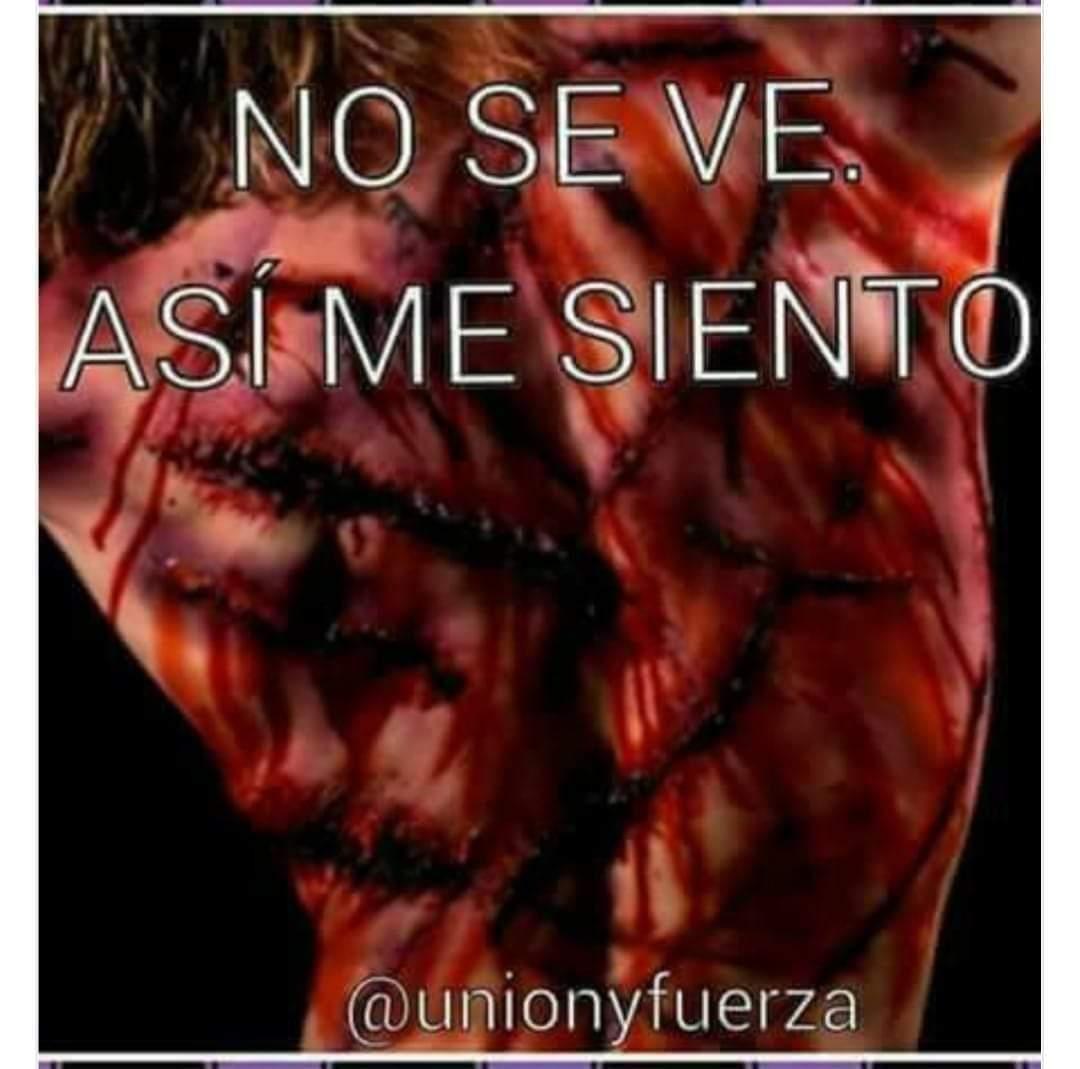 lolagalvez7's tweet photo. #fibromialgia #SFC #encefalomielitismialgica #dolor #depresion #ansiedad #angustia #incompresion #autoinmunes #respeto
@beltra_nuria
@Hazlo_Visible https://t.co/Oux98Envgz