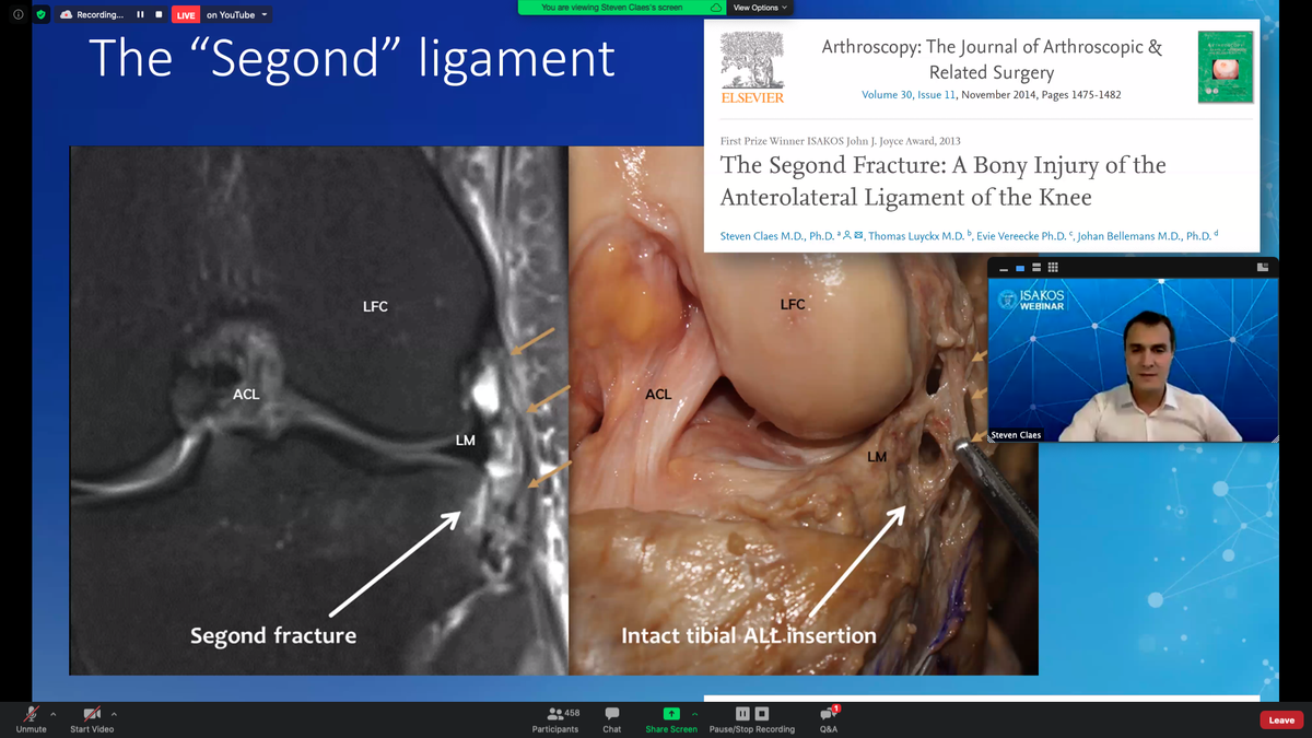 Dr. <a href="/drstevenclaes/">Steven Claes</a> of Belgium opens the #ISAKOSwebinar:
The #Anterolateral Ligament: Let’s Stick to The Facts! #ALL

Register to join at isakos.com/webinars or check out the live-stream on YouTube: youtube.com/c/ISAKOSSociety
