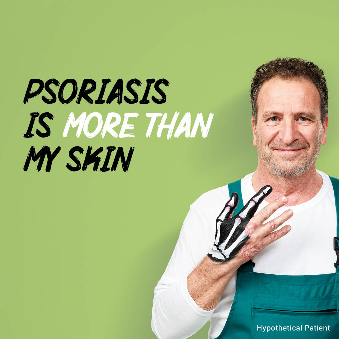 psoriasis forum australia scalp psoriasis treatment