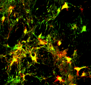 GeneTherapy_SN's tweet photo. Online this week, a preclinical #gttech for #neurodegenerativedisease @CHUVLausanne and @unil combines #lentiviral retrograde transport with surgical and cell-specific #genedelivery to improve transgene distribution in the central nervous system➡️https://t.co/qodrlFbpWX https://t.co/Agdd8c4DQW