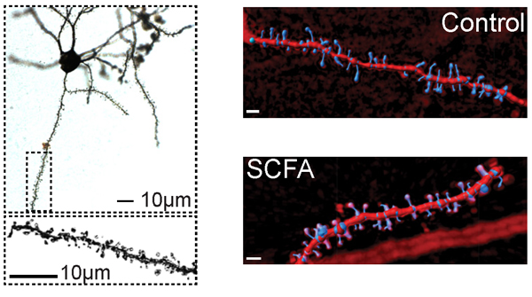 Gut bacterial diversity &amp; production of short-chain fatty acids decline after stroke, impairing brain repair. Recovery can be improved by dietary supplementation of the fatty acids. Read about this work by <a href="/rebeccaksadler/">Rebecca Sadler</a> in a Journal Club <a href="/JNeuroscience/">Journal of Behavioral Neuroscience</a>
bit.ly/JNJC070820