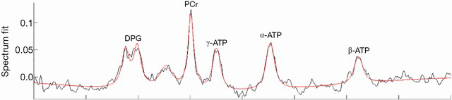 The MR is tuned to hydrogen for imaging, but re-tune to phosphorus and you'll those atoms occupying different 'chemical shifts' (frequencies) as they sit in different chemical environments. Here's the P spectrum from a human heart: Phosphocreatine and ATP.