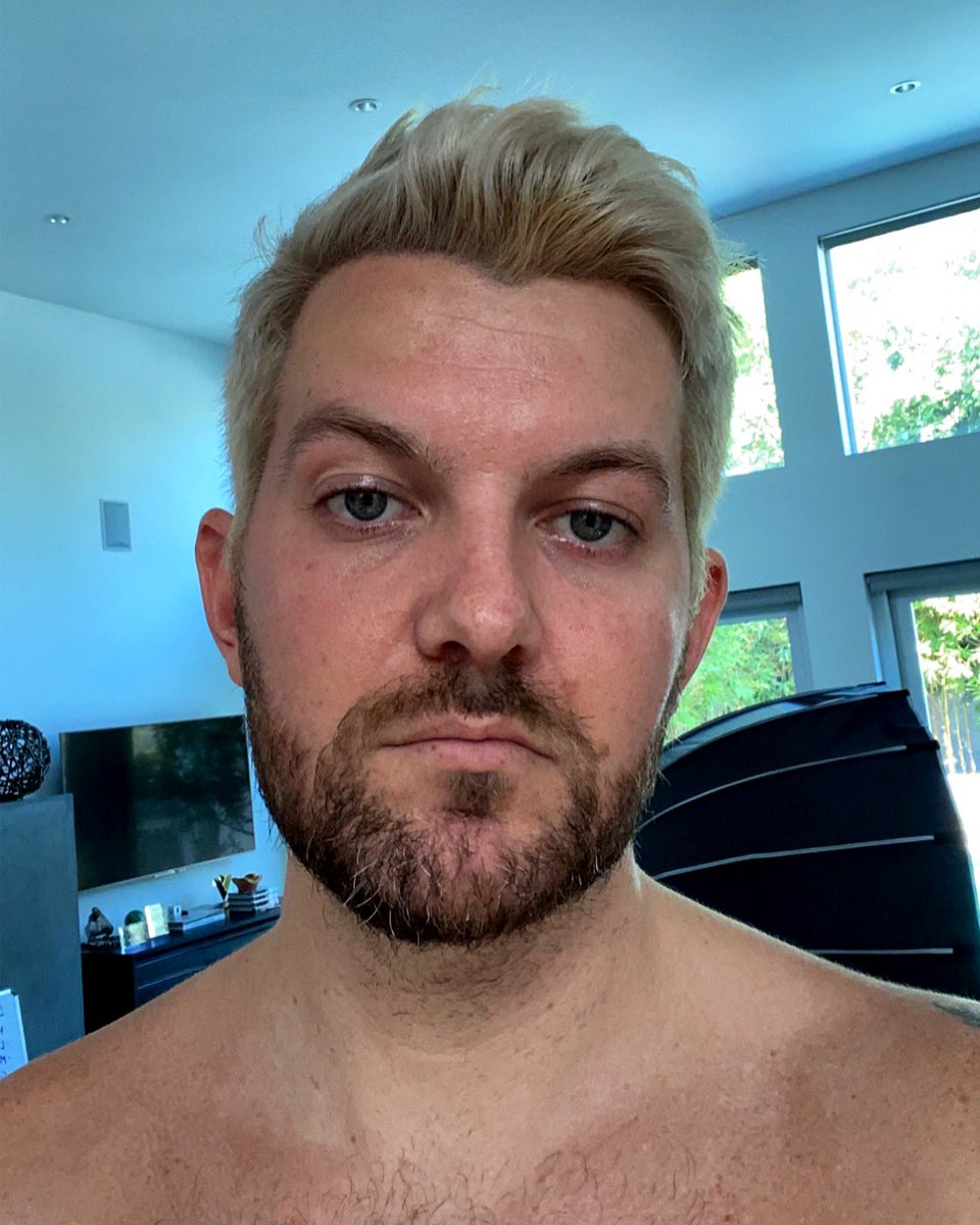DillonFrancis's tweet photo. A bird shit on my head https://t.co/cRx1ALvE21