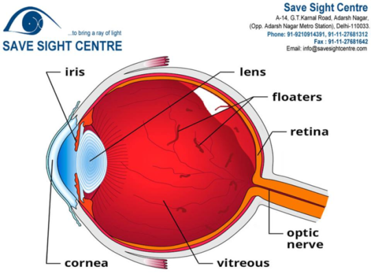savesightcentre's tweet photo. Anyone can get floaters or light flashes in their eyes. Floaters can take different shapes.If you experience a sudden increase in floaters or flashes, you should seek medical care.
#Floaters #EyeHealth #EyeFlashes #BestEyeDoctor #DrRajeevJain #SaveSightCentre Call us: 01127681312 https://t.co/TD6LOvjga2