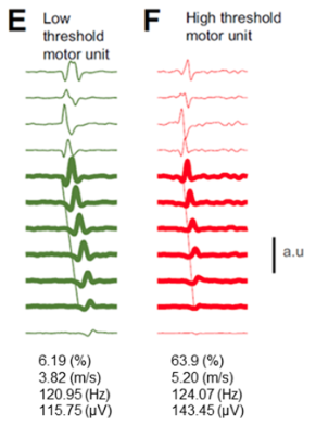 [11/27]Matrix orientationIt shouldn't matter much in theory (?)Maybe better results if it is oriented in relation to the propagation of action potentials? If we do this, we can also estimate conduction velocityFigure below:  @AlecsDelVecchio et al https://www.sciencedirect.com/science/article/pii/S1050641120300419