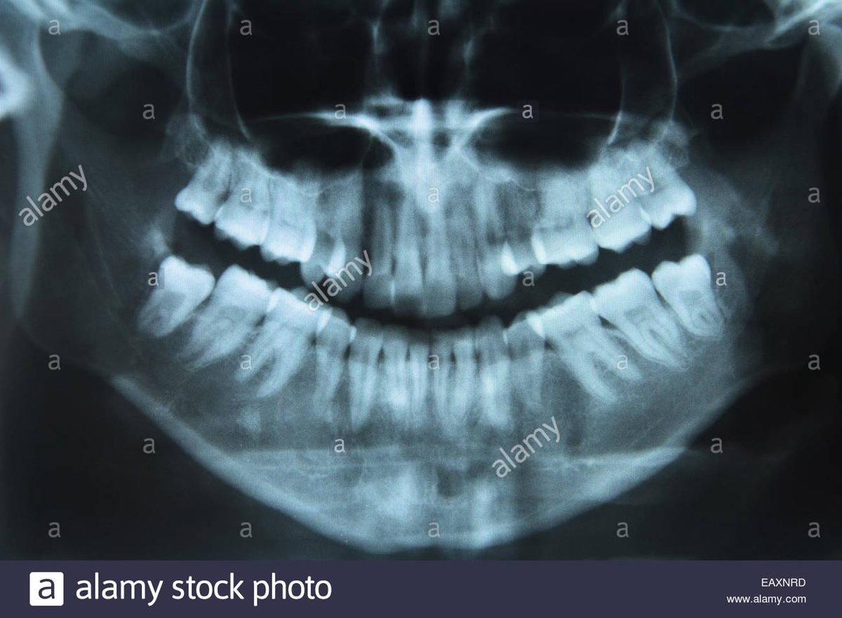sai_sameera2's tweet image. #Join us in a very #interesting &amp;amp; #interactive virtual #webinar #dentalcongress2020 Oct 19-20,2020 and #dentalworld
#submit your recent #fulllengthartical as webinar