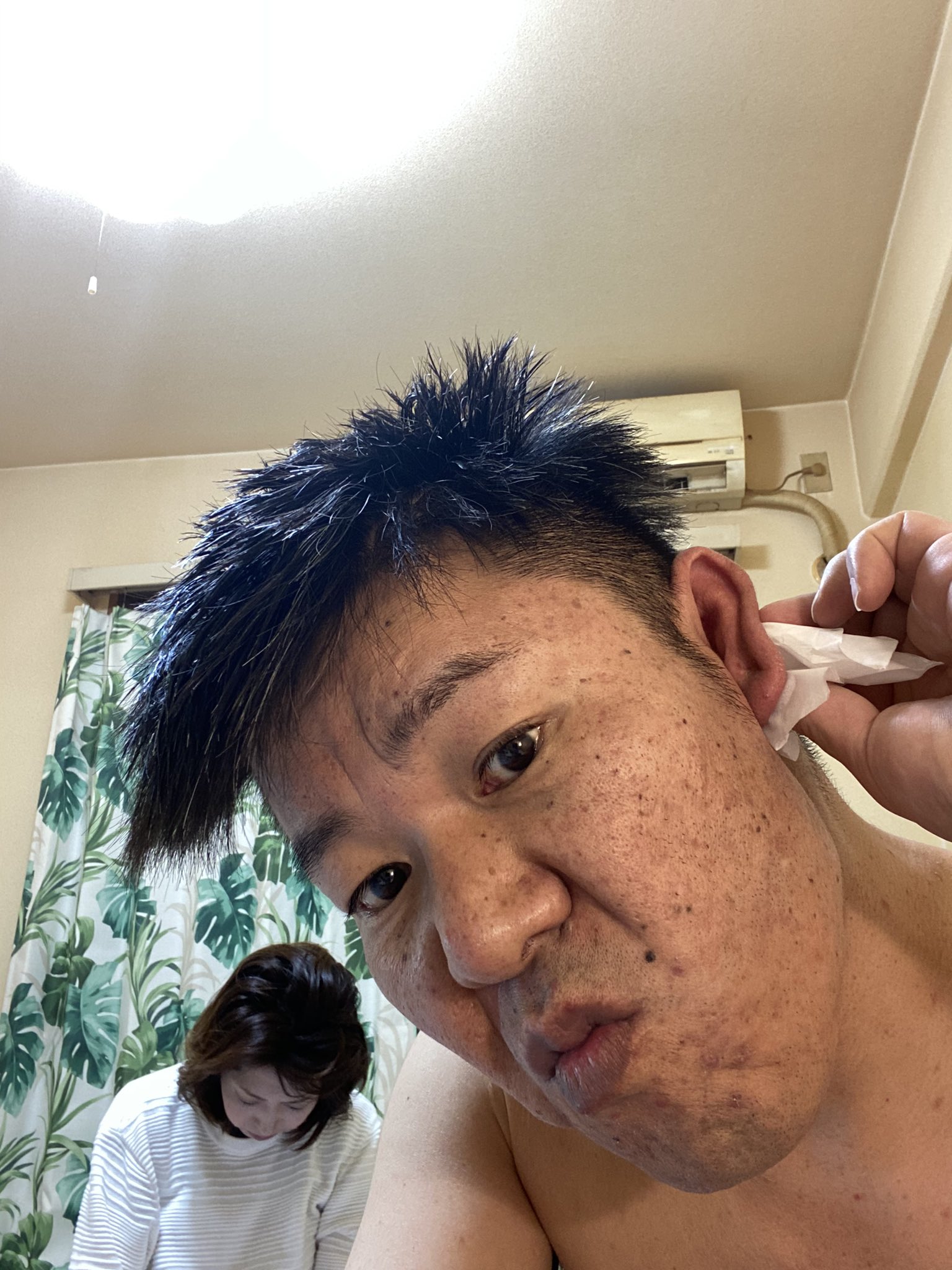 金 バエ 肌