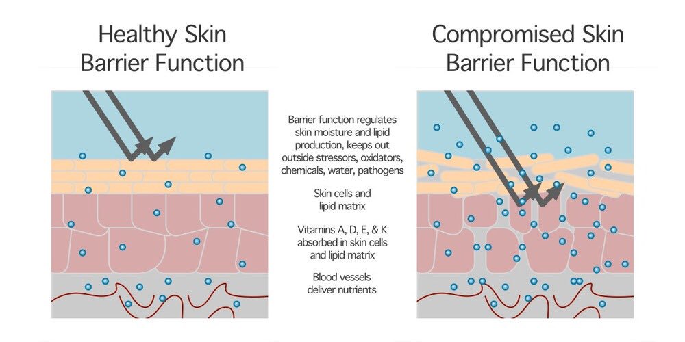 SkinBodyRenewal's tweet photo. To put it simply, your skinโs barrier function involves the uppermost layers of your skin & its ability to do two things - keep moisture in & keeping irritants out https://t.co/mwajfQNfAk
#SkinRenewalSA #skin #skinbarrier #barrierrepair #reactiveskin #beauty #BusinessEssentials https://t.co/P5cTMQCkV9