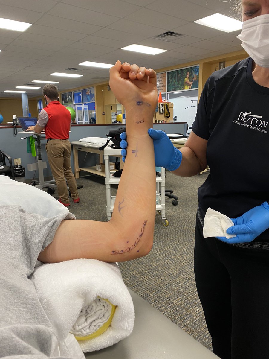 NoahSamol's tweet photo. Unfortunate way to end the season but a huge thank you to @BeaconOrtho and @TKremchekMD for the surgery and patient care. Minor setback for a major comeback! The road to recovery starts here! https://t.co/gXywdtgo5U