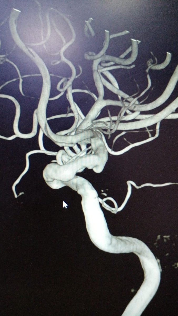 anooptweetz's tweet image. #pipelineflex  with #shieldtechnology