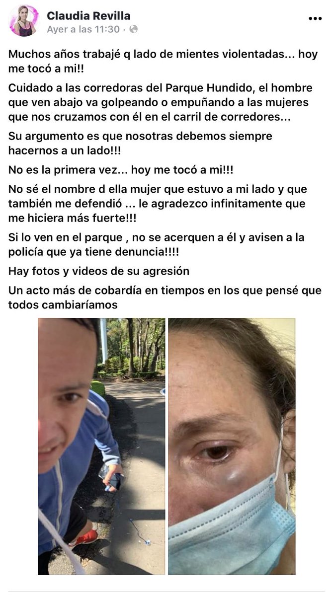 KermitDice's tweet photo. @BJAlcaldia @STaboadaMx por favor mas seguridad en el #parquehundido ya no se puede andar seguro en ningún lado o que ?? https://t.co/Z9XaizfPxq
