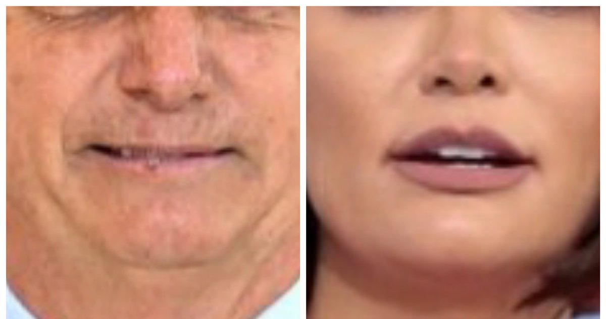 _Fora_Bolsonaro's tweet photo. Então, essa boca com Covid, beija essa sem Covid? 😲 https://t.co/g3wKXOSayi