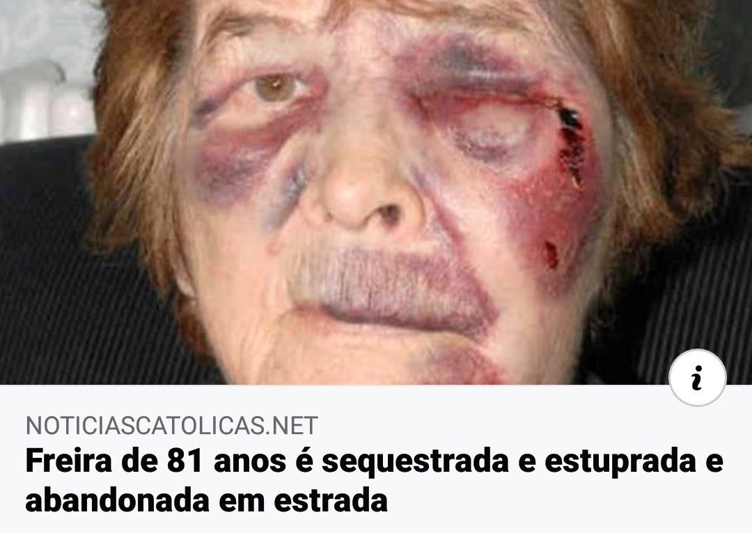_aesantt_'s tweet photo. será q foi a roupa curta? ou ela estava pedindo? https://t.co/48eIE5K6m6