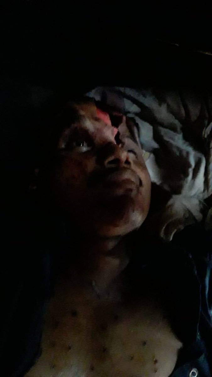 bosawas10's tweet photo. El día de ayer los colonos invasores de nuestras tierras indígenas atacaron brutalmente con armas de fuego a mis hermanos indígenas de la comunidad de Ahsawas, acabando con dos vidas de nuestros hermanos indígenas mayangnas. Condenamos y repudiamos este acto de violencia... https://t.co/g5hsFC7Fc2