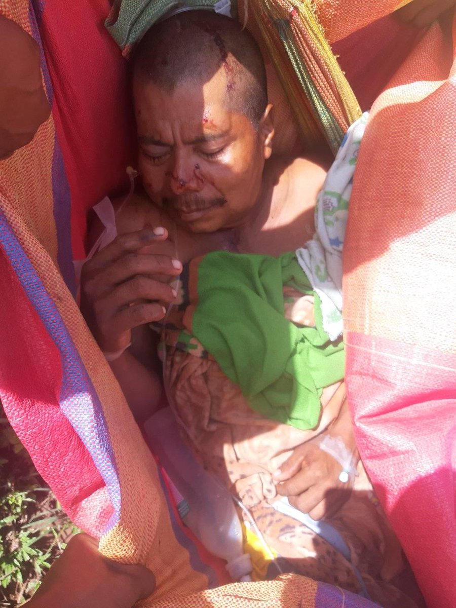 bosawas10's tweet photo. El día de ayer los colonos invasores de nuestras tierras indígenas atacaron brutalmente con armas de fuego a mis hermanos indígenas de la comunidad de Ahsawas, acabando con dos vidas de nuestros hermanos indígenas mayangnas. Condenamos y repudiamos este acto de violencia... https://t.co/g5hsFC7Fc2