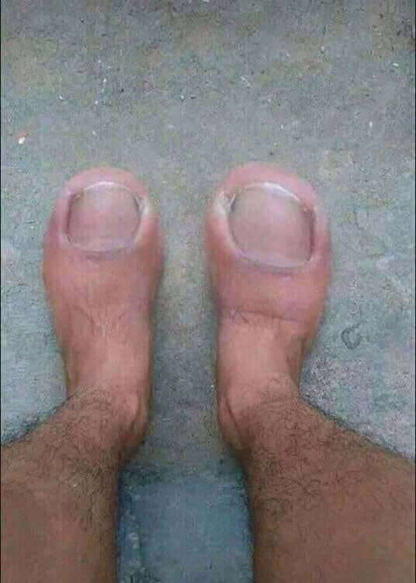 ulebmybot's tweet photo. @BleacherReport Masvidals toes tomorrow https://t.co/gjPOb7lB2N