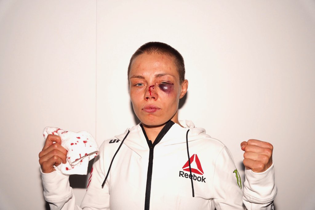 Thug <a href="/rosenamajunas/">Rose Namajunas</a>
