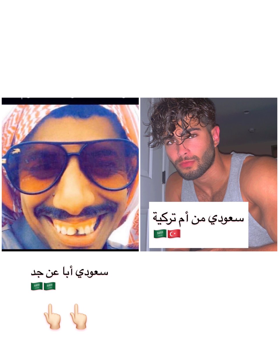 KsaMixx's tweet photo. المشهبات ذو الجينات المضروبة والتصبغات وكل أنواع الخياس والقرف ما يحبون يذكرون أنه مهند الحمدي سعودي جداوي و جدته تركيه🤧😹😹🇹🇷🇸🇦  الملامح التركيه بارزه عليه
 #صباح_الخير #تسهيل_الزواج_من_اجنبيه10 #تسهيل_الزواج_من_اجنبيه9 #تسهيل_الزواج_من_اجنبيه٧ #السعوديات_الاجمل_عالميا https://t.co/4GXFo9Eug3