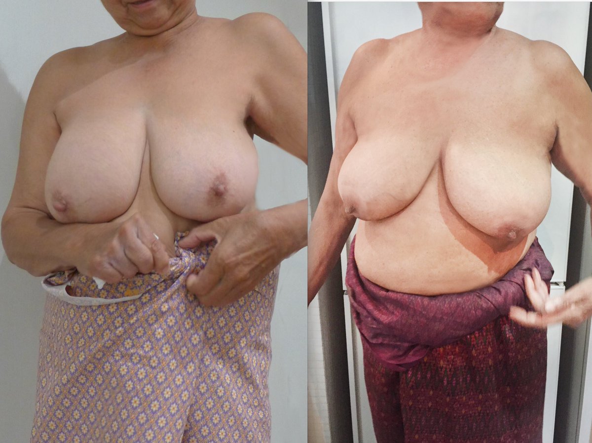 ถ้าเป็นคุน คุนจะเลือกทางขวา  หรือทางซ้าย