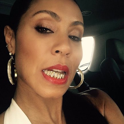 Let’s talkGRILLS Gold teeth were first worn by women of Etruscan civilization as early as 800 BC. "Certain high-status Etruscan women deliberately had [front teeth] removed in order to be fitted with a gold band appliance holding a replacement, or reused, tooth," —John Becker