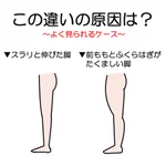 脂肪が原因じゃない!？脚が太くなってしまうのは骨や筋肉が要因かも!